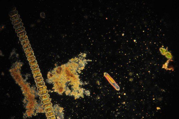 Un gros plan d'un microscope montre de nombreux types de bactéries différents.