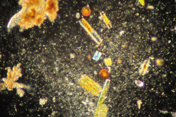 Un gros plan d'un microscope montre de nombreux types de bactéries différents.