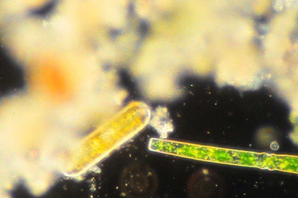 Un gros plan d'une algue verte et jaune au microscope.
