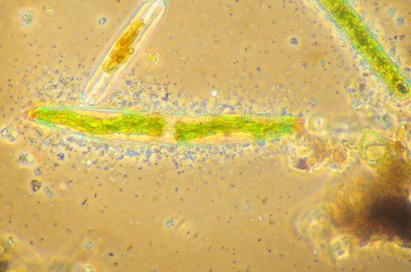 Un gros plan d'une algue verte au microscope.