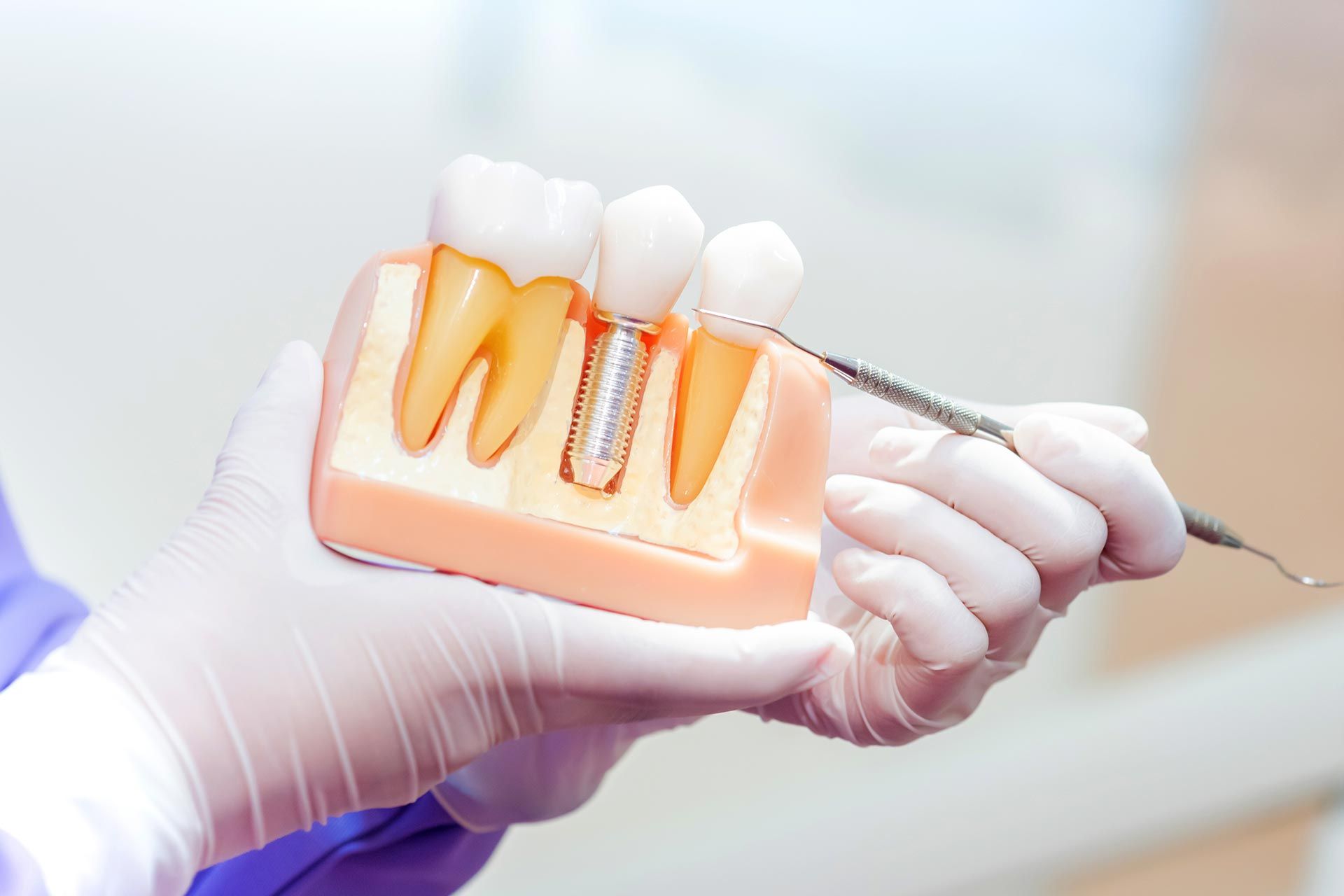 Gloved hands holding a dental model with orange roots and a metal tool nearby Gloved hands holding a dental model with orange roots and a metal tool nearby