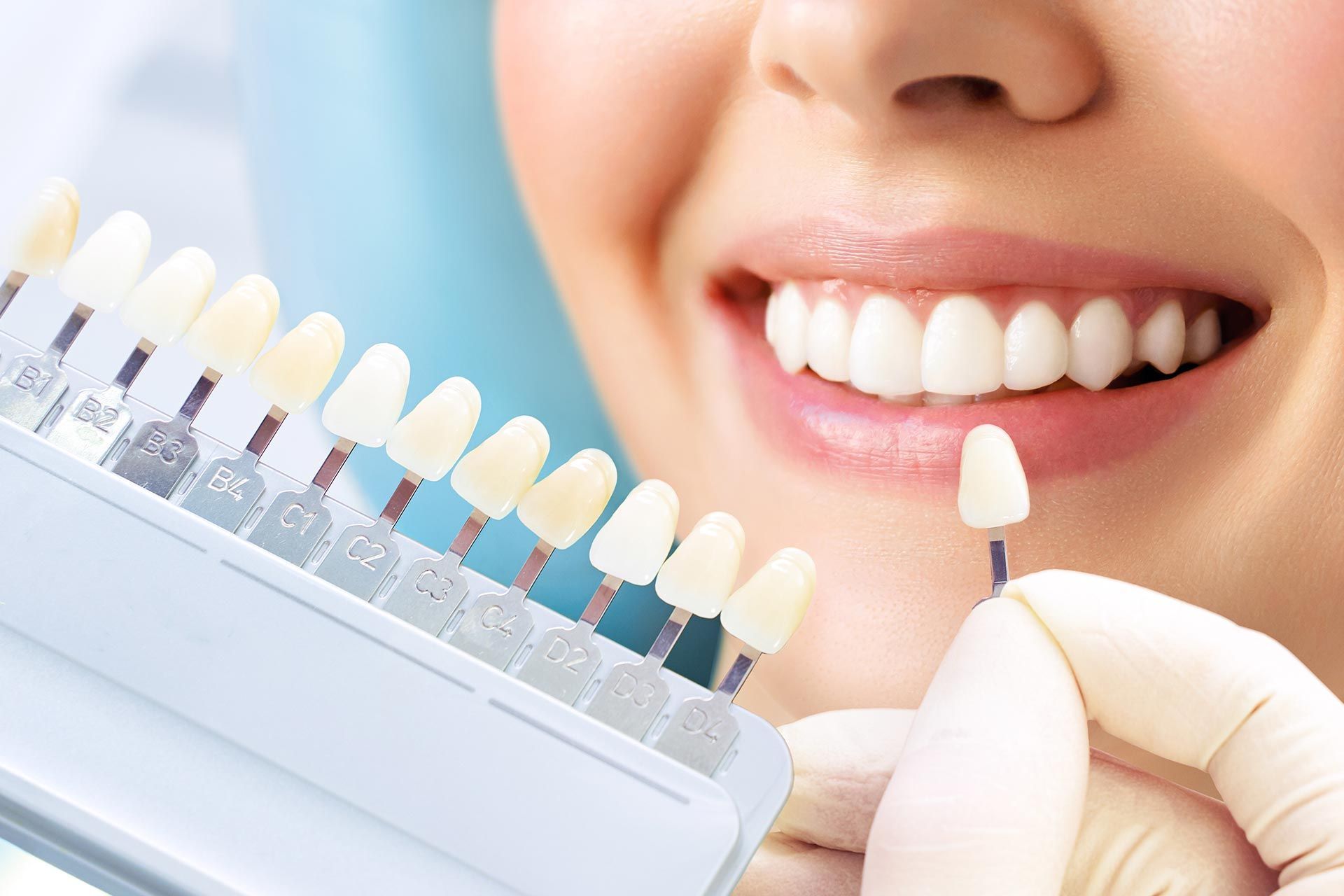 Dentist holding a tooth shade guide beside a smiling mouth