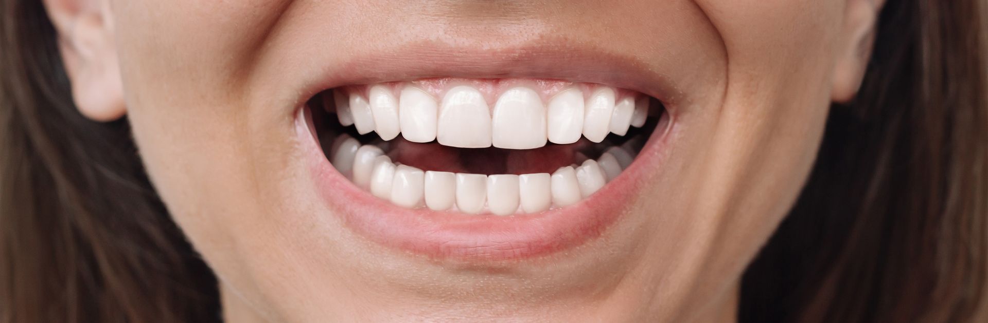 cosmetic dentistry after photo smile makeover Naples FL David O'Sullivan DMD