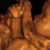 Sepia-toned ultrasound image showing a baby’s feet and legs curled together