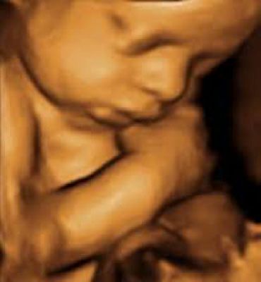 Sepia-toned ultrasound of a curled fetus with hand near face