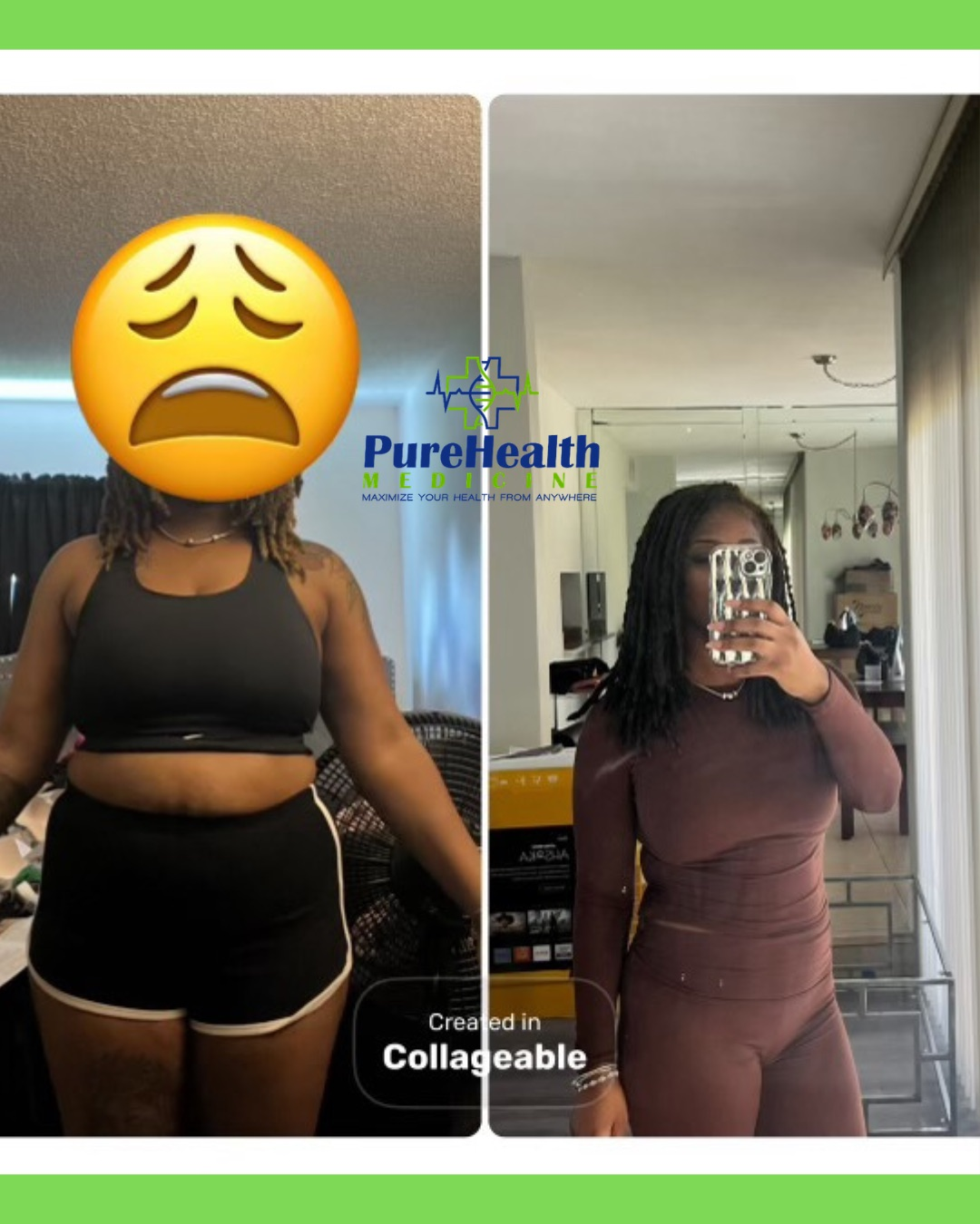 Weight Loss Treatment