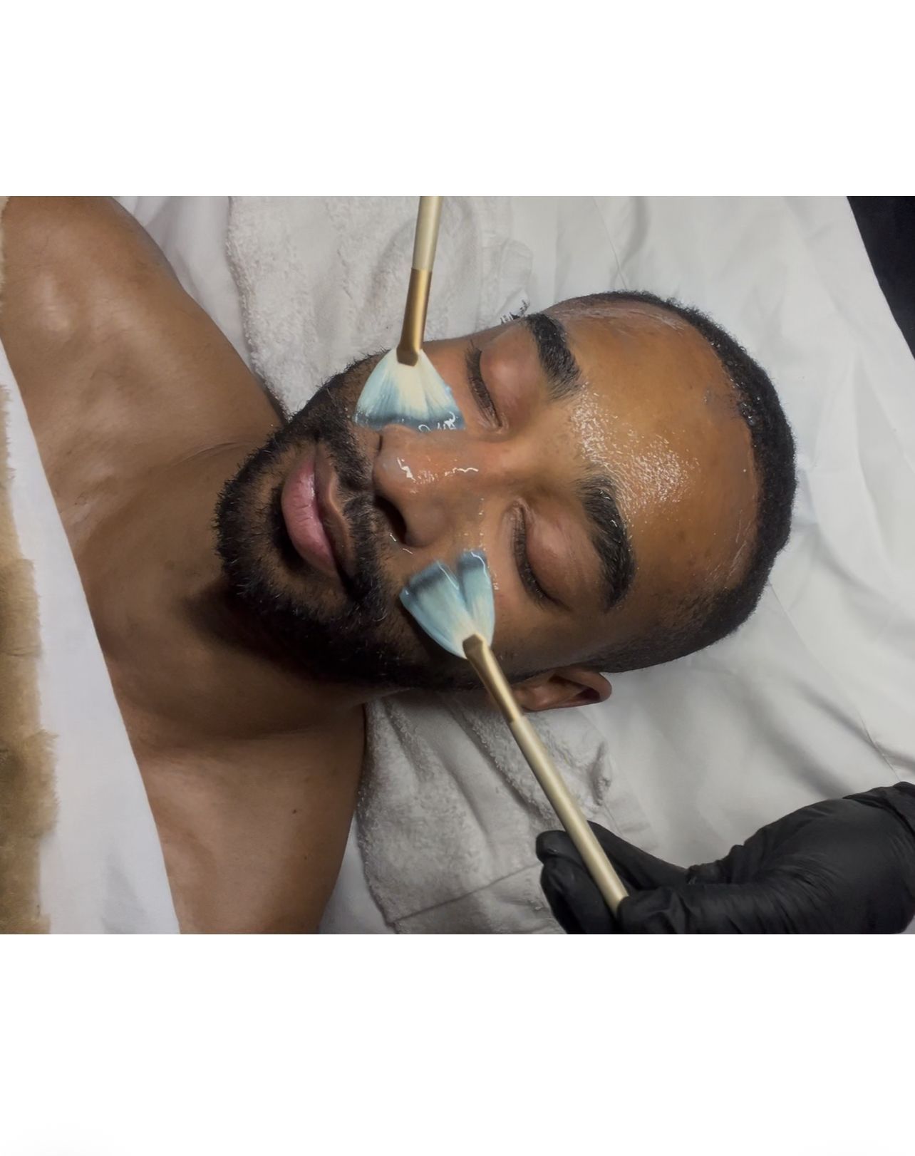 Person lying on a bed during a facial treatment, with blue cream applied to the face.