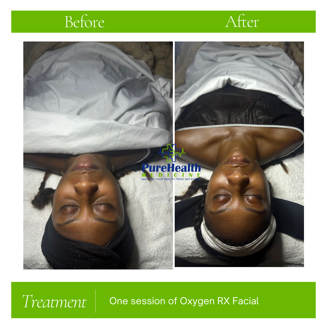 Before-and-after spa treatment photos of a client lying down, labeled