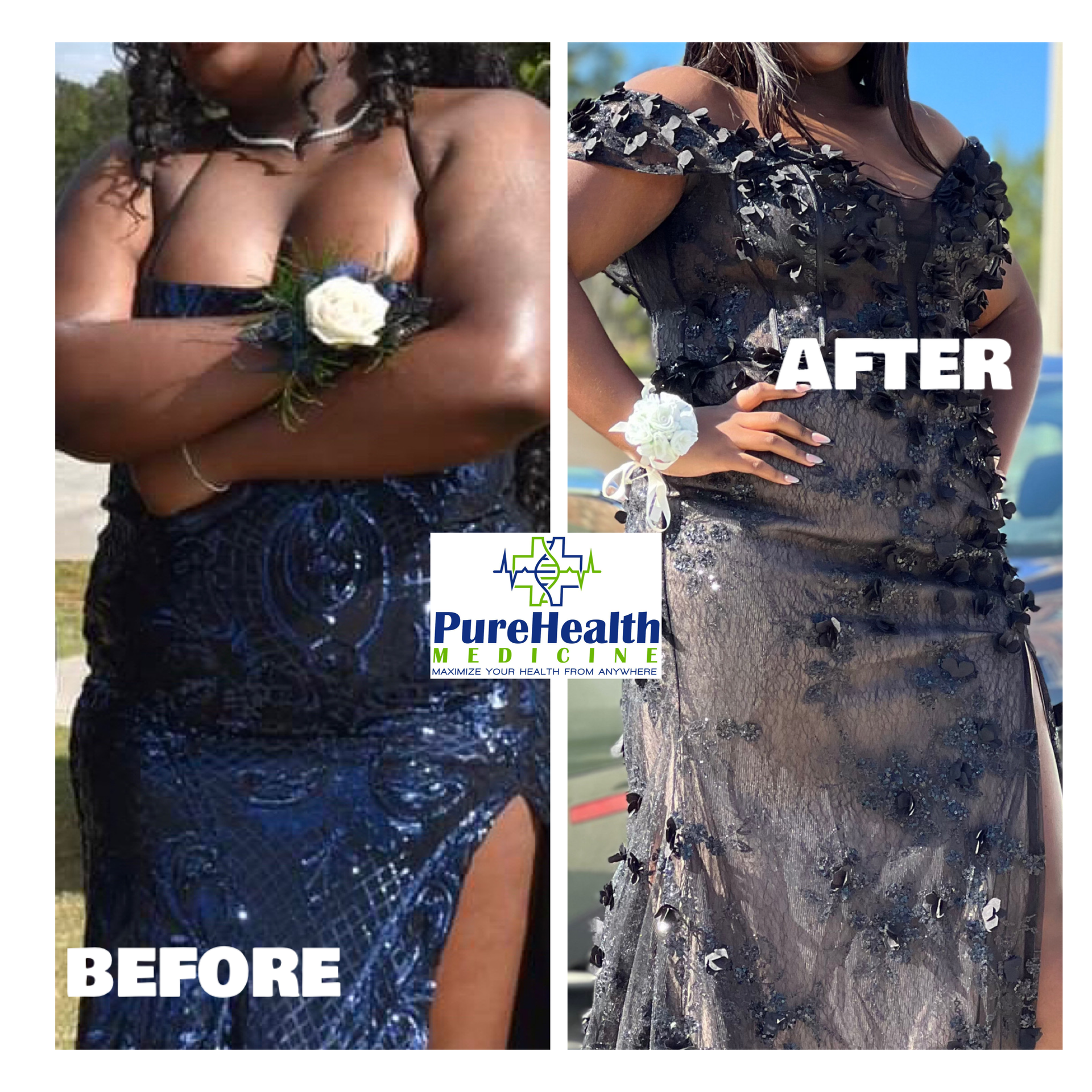 Split-screen before-and-after of a navy dress makeover, with “BEFORE” and “AFTER” labels and a PureHealth logo.