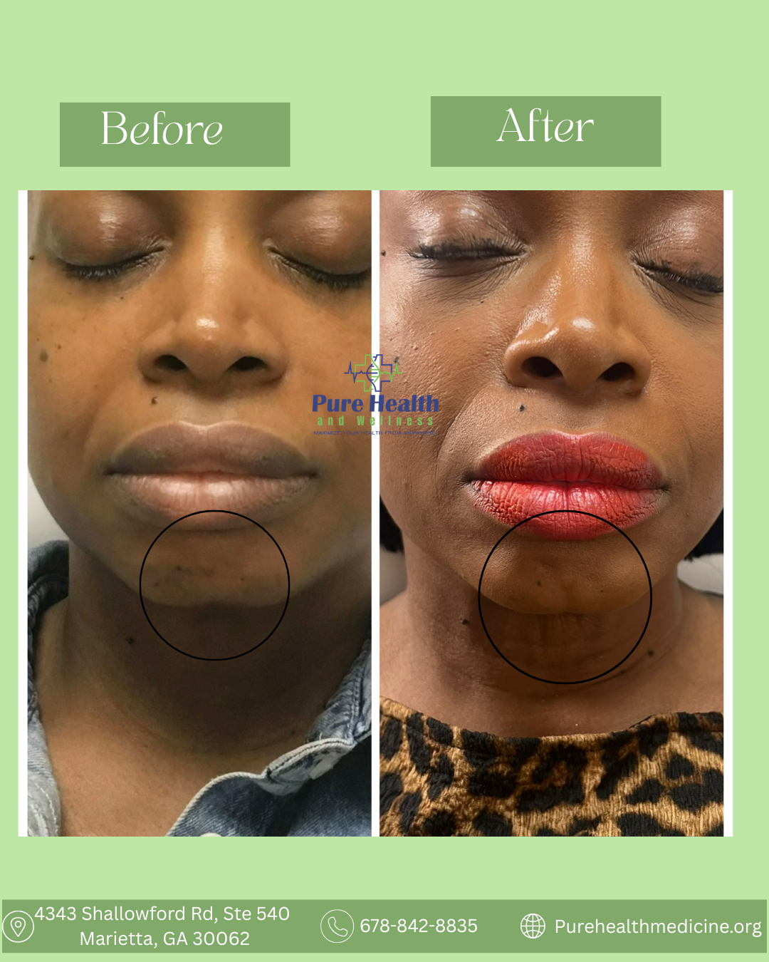 Before-and-after face close-up showing skin changes, with the after image featuring redder lips and clearer skin.