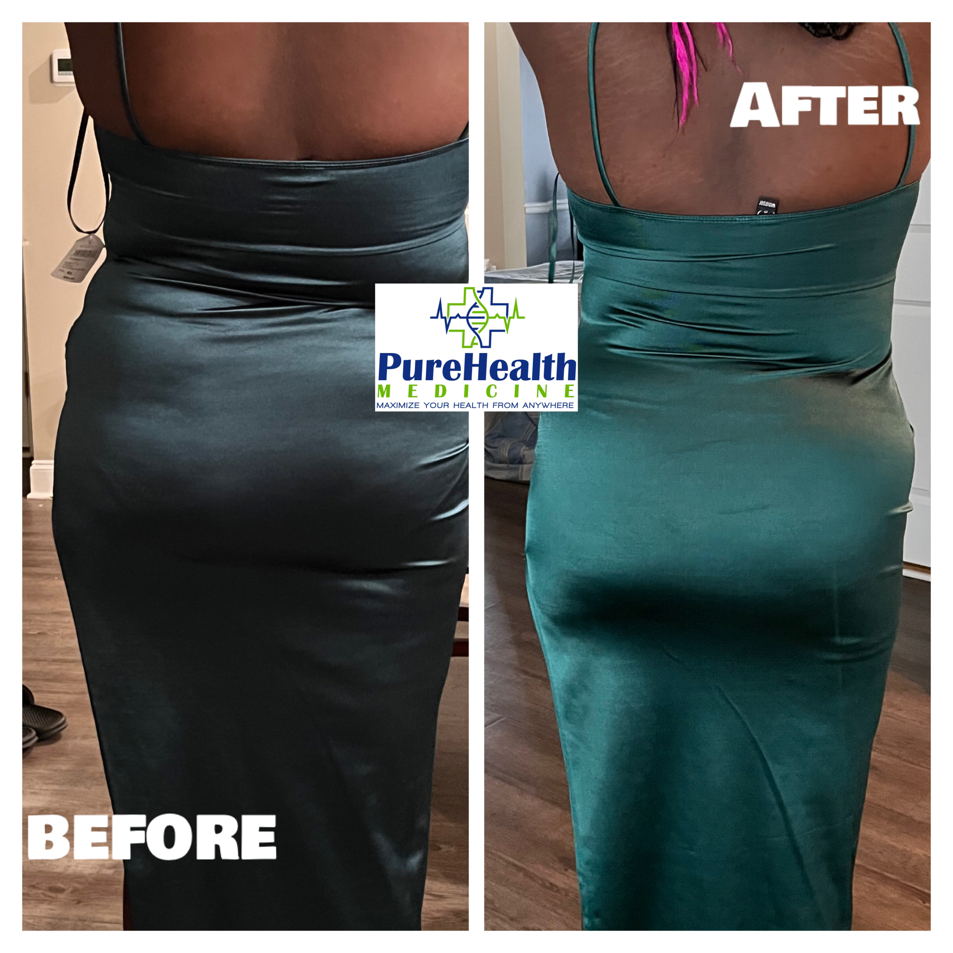 Before-and-after waist and hip comparison in black and teal skirts, labeled “BEFORE” and “AFTER.”