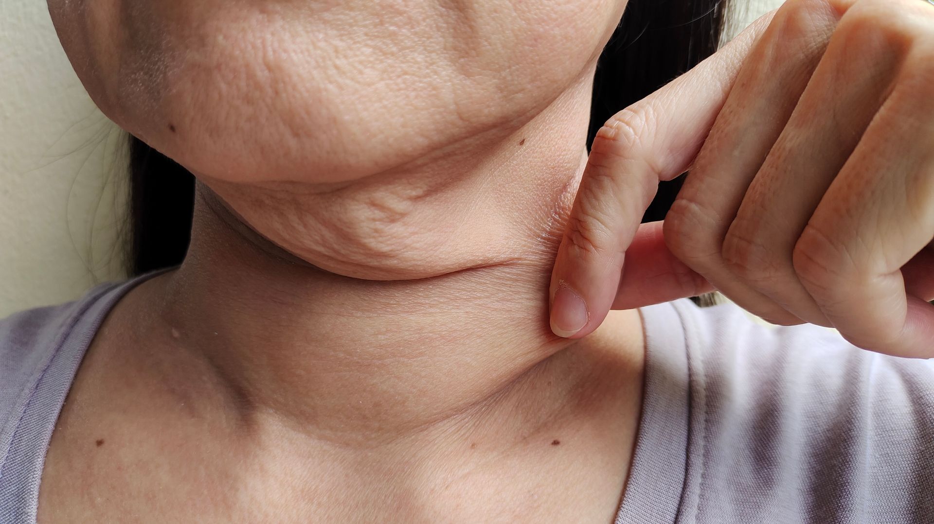 Hand pointing to a raised red swollen area on the side of a neck