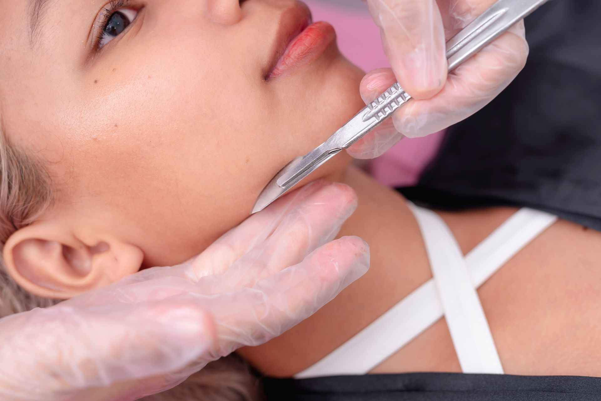 Gloved hands injecting filler into a woman’s chin with a syringe during a cosmetic procedure