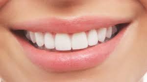 invisalign clear aligners dublin