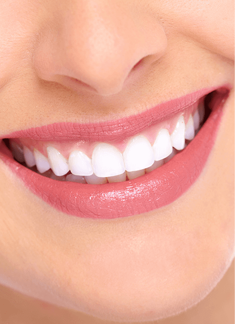 Smile Makeover - Park Place Dental