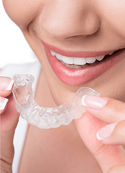 Invisalign - Park Place Dental