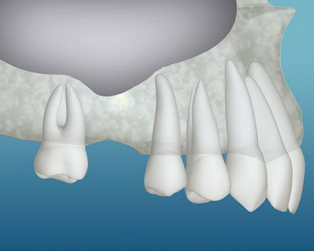 teeth image