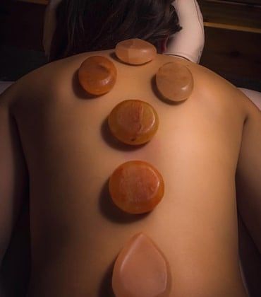 Back with five warm-toned suction cups arranged down the spine during cupping therapy