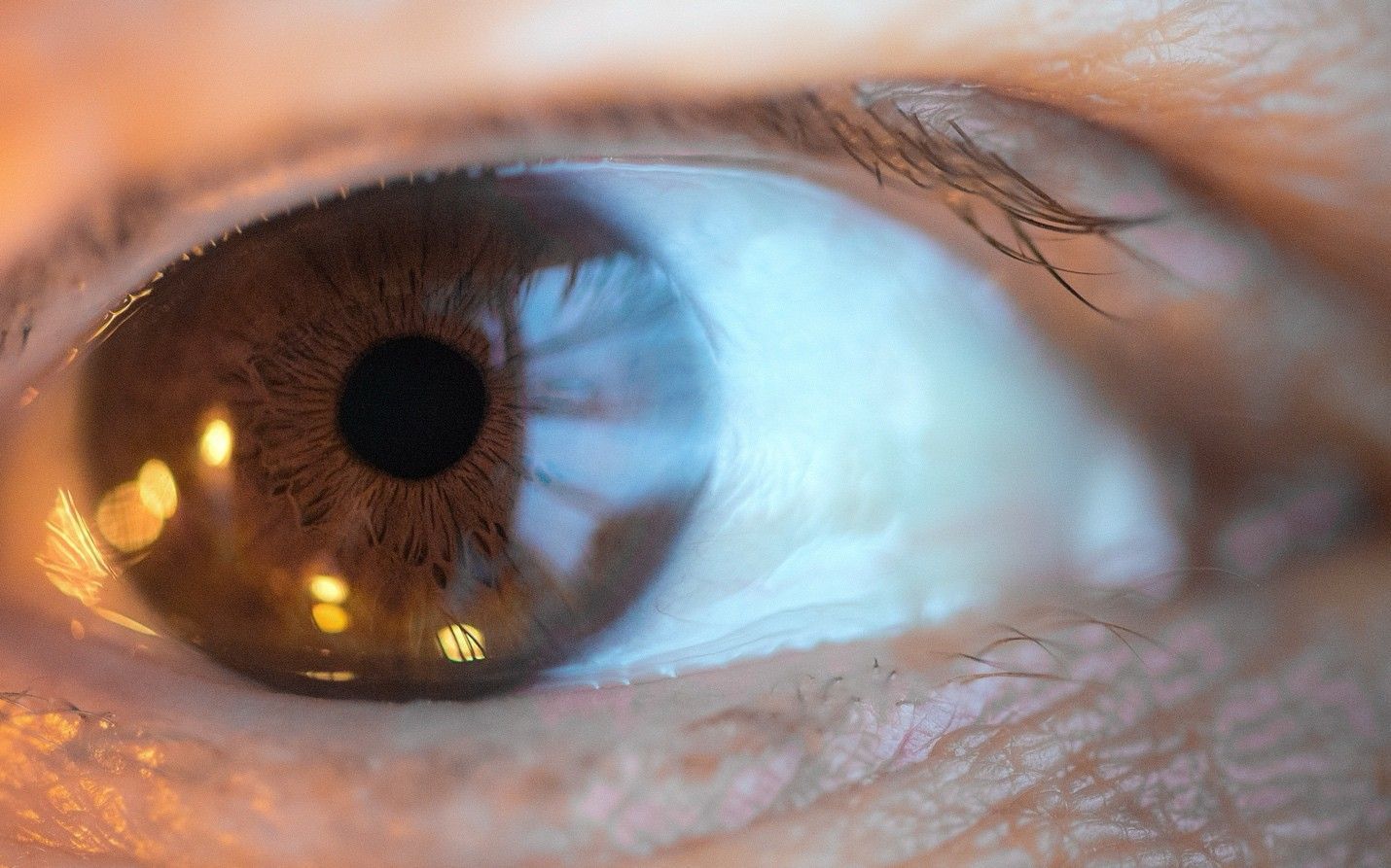 Eye Floaters and Flashes: When Are They a Warning Sign?