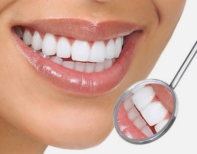A close up of a woman 's smile with a dental mirror.
