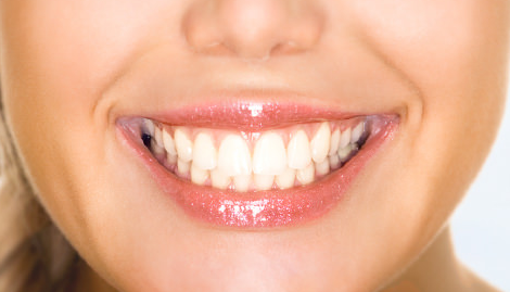 A close up of a woman 's smile with white teeth.