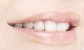 A close up of a woman 's mouth with white teeth.