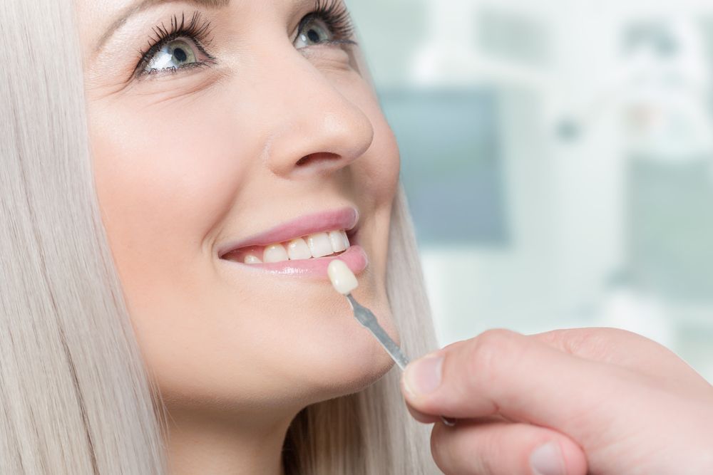 Dentist Uses a Shade Guide to Match the Tooth Colour — Killara Dental in East Killara, NSW