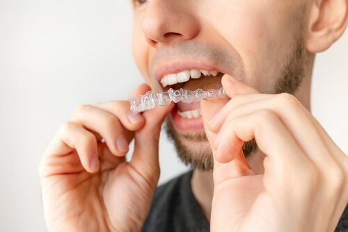 A Person With a Beard Uses Both Hands to Place a Clear Plastic Dental Aligner — Killara Dental in East Killara, NSW