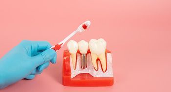 A Gloved Hand Holds a Toothbrush Over a Model of a Human Jaw — Killara Dental in East Killara, NSW