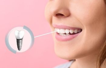 A Smiling Person Shown Next to a Circular Graphic of a Dental Implant — Killara Dental in East Killara, NSW