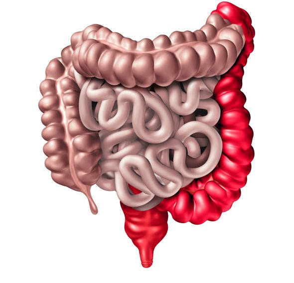 proctologo