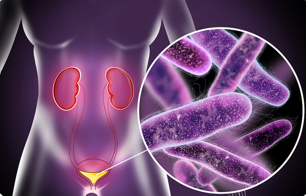 Urinary infection treatment by telemedicine