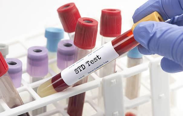 STD testing with My Brazilian Doctor