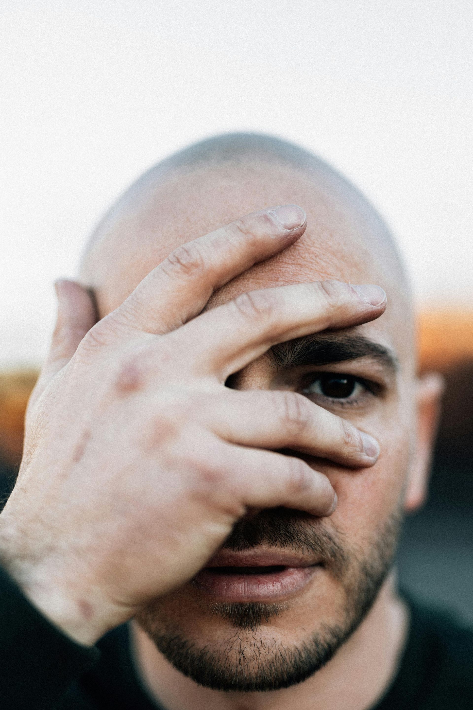 Close-up of a man covering one eye with his hand, looking at the camera.