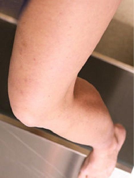 A close up of a person 's elbow and foot