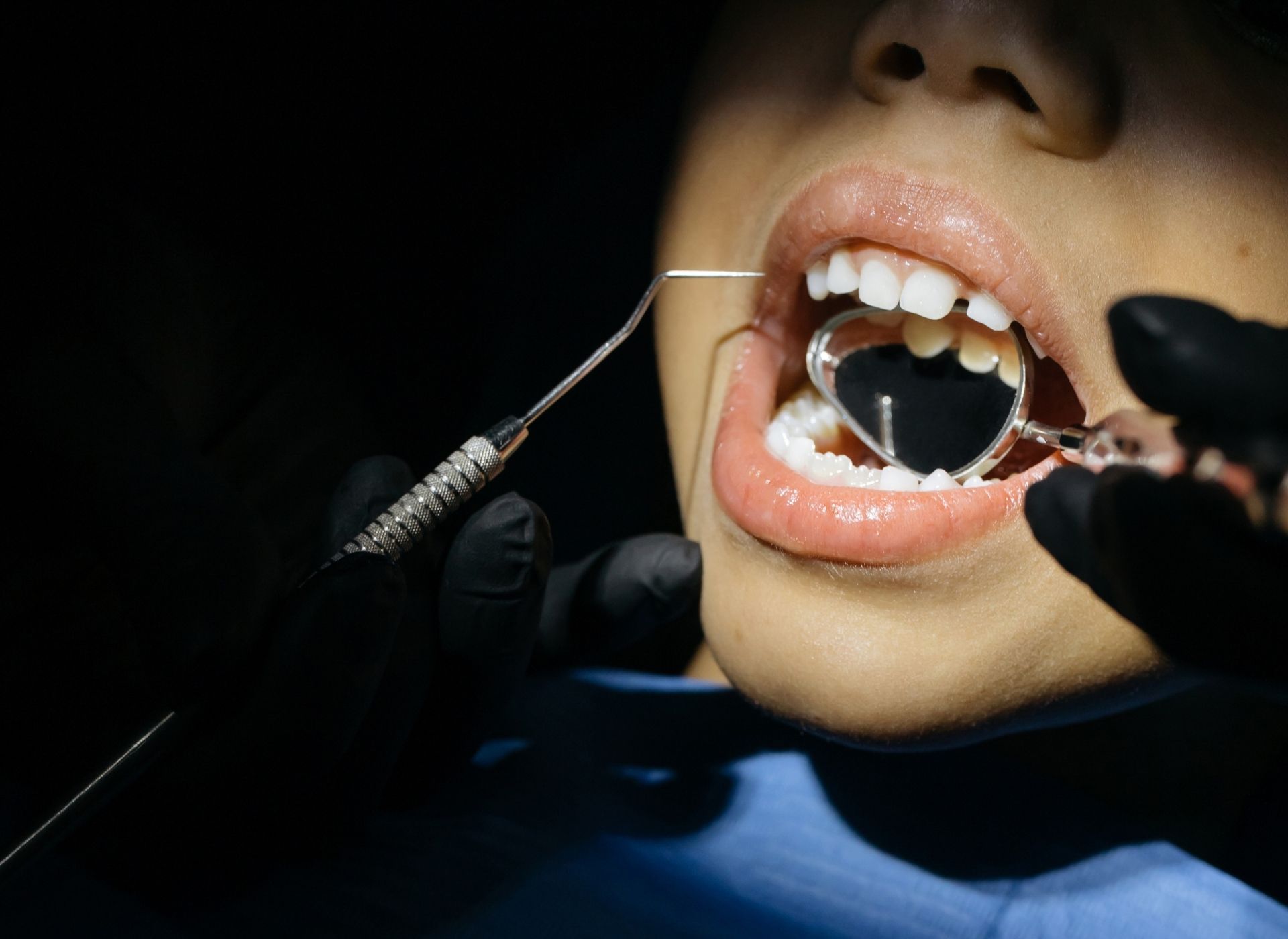 Dentist examining a person's teeth with a mirror and probe in a dental office.
