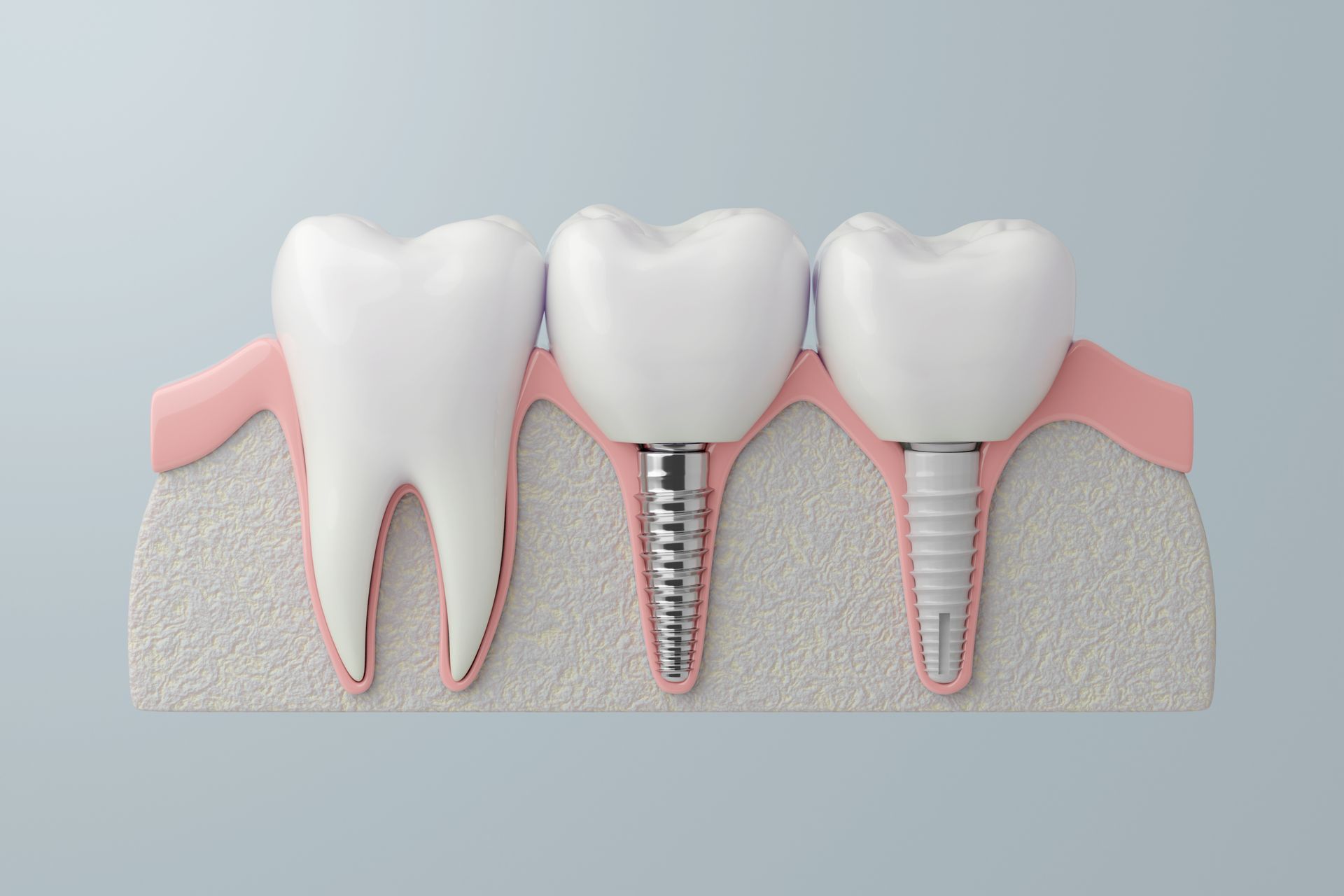 Woman in dental chair with mouth open, dental tools in use.