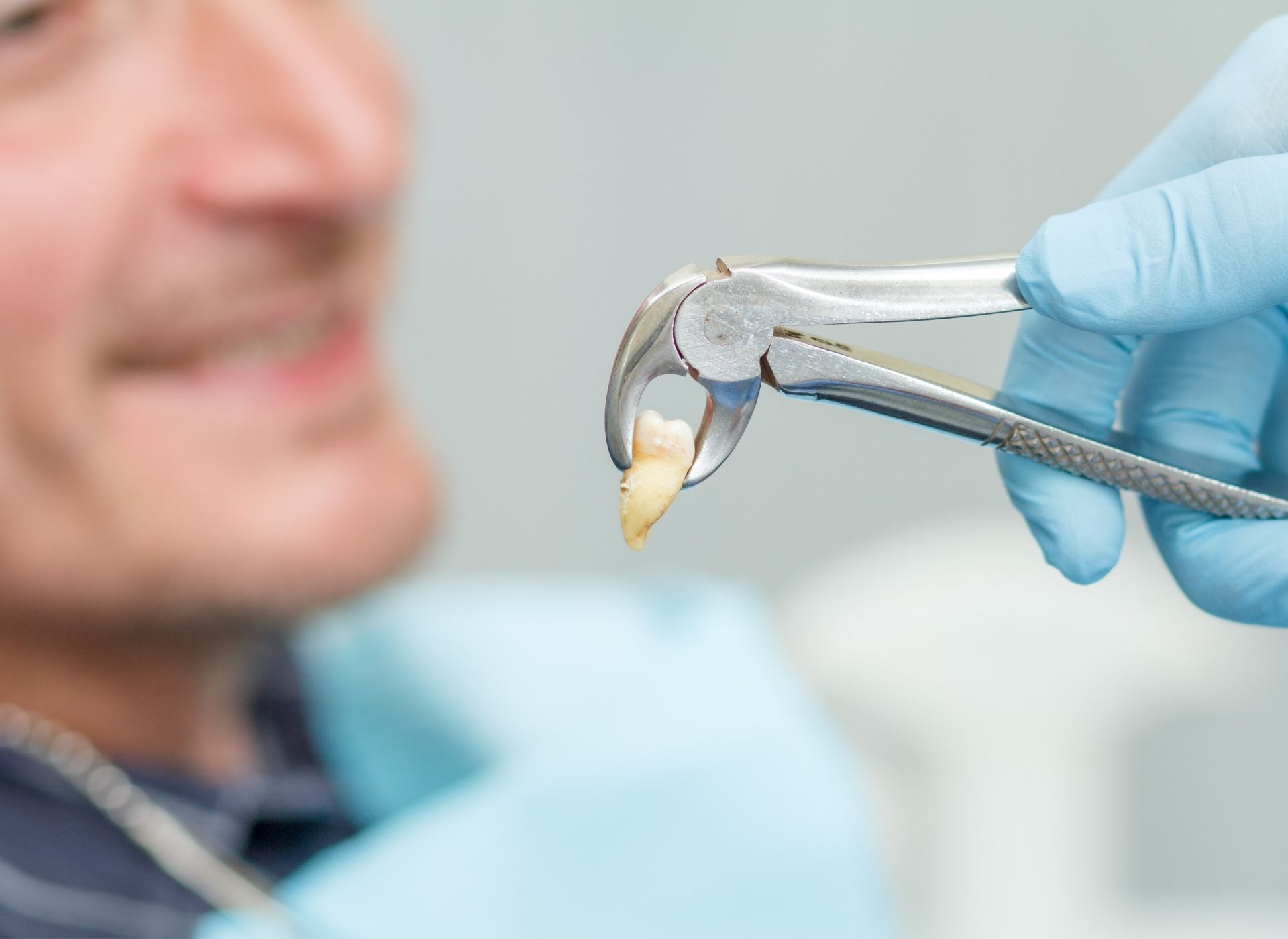 Tooth extraction: Dentist's gloved hand holding dental pliers with extracted tooth. Patient in background.