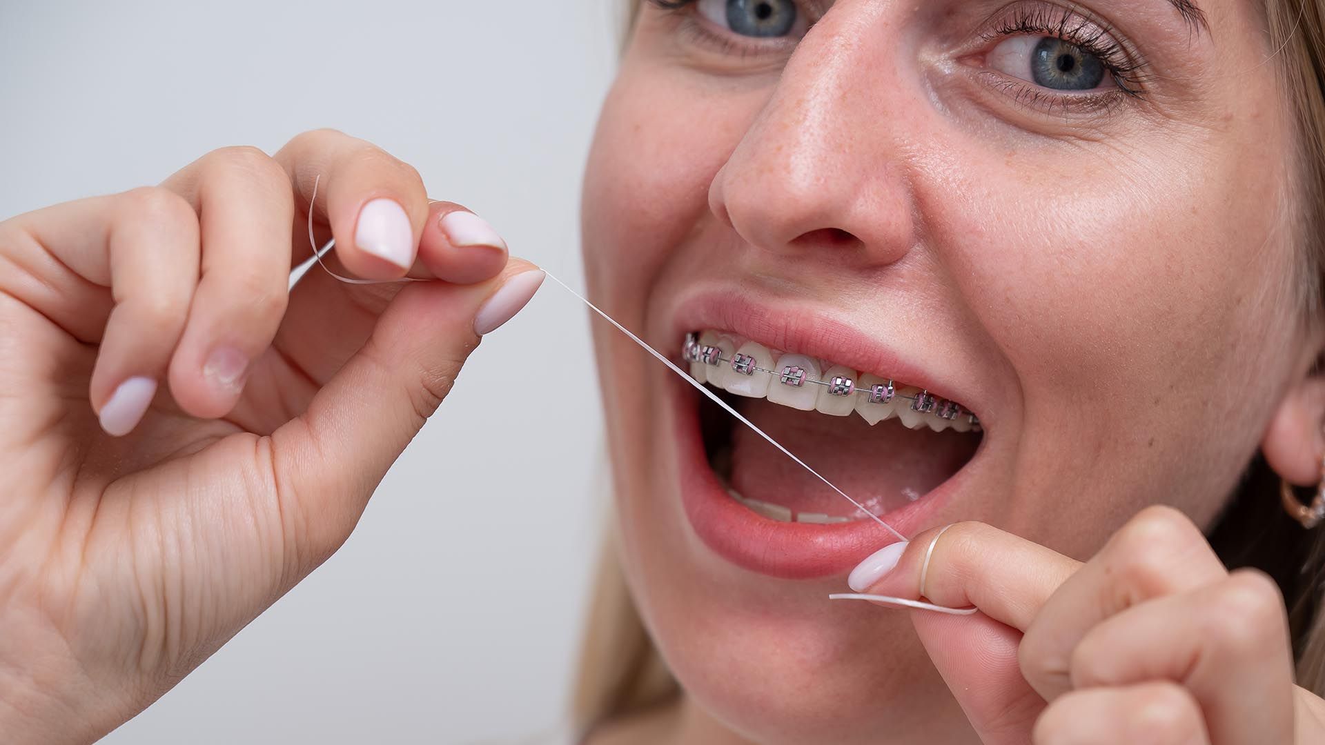 How Do You Floss With Braces? Your Complete Guide