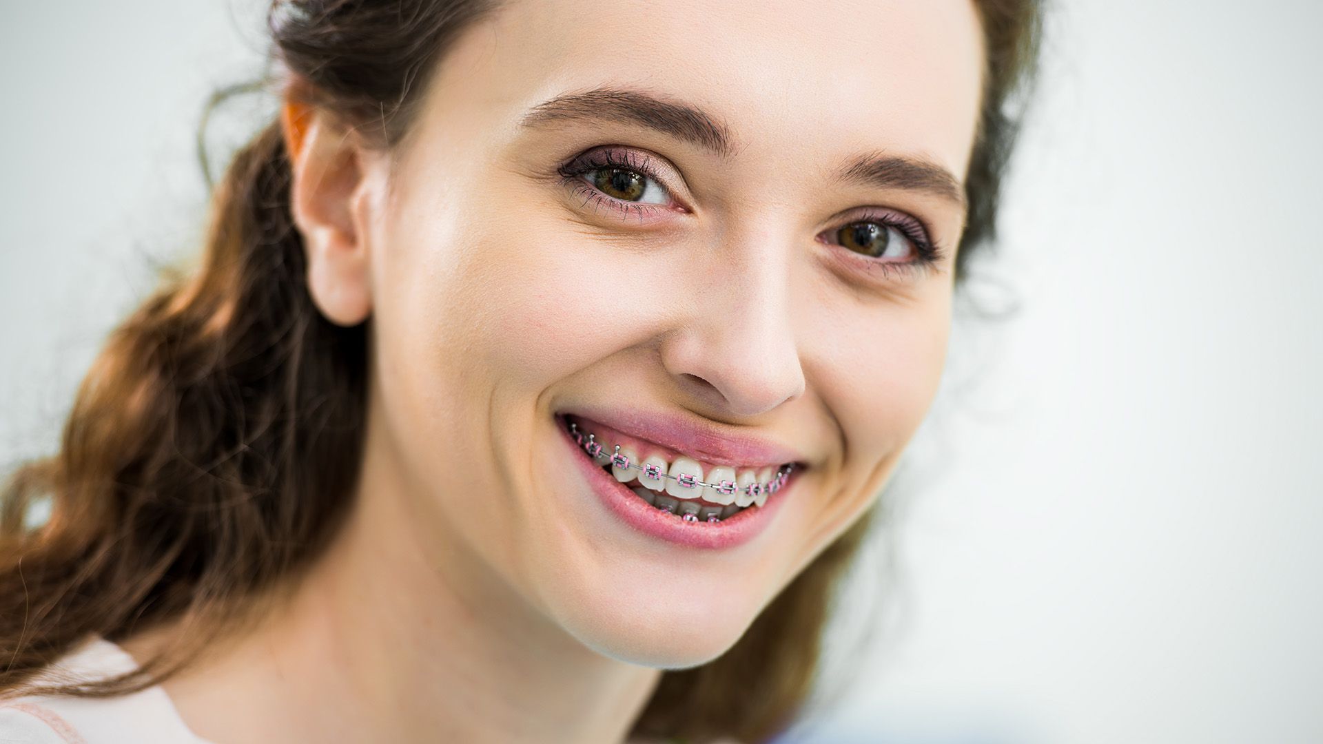 Can You Get Braces the Same Day as Your Consultation?