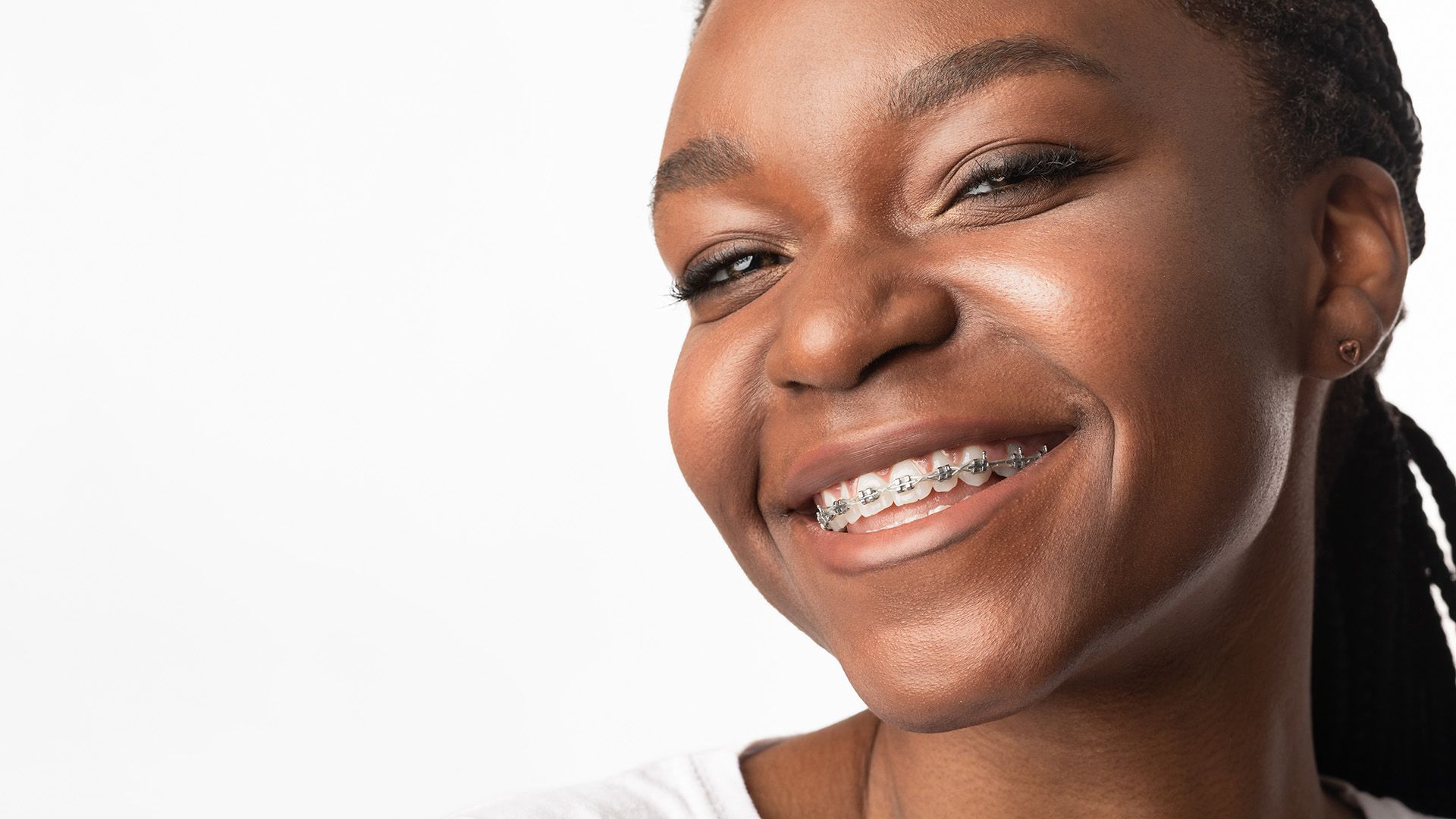 How Are Clear Braces Different from Metal Braces? A Patient’s Guide