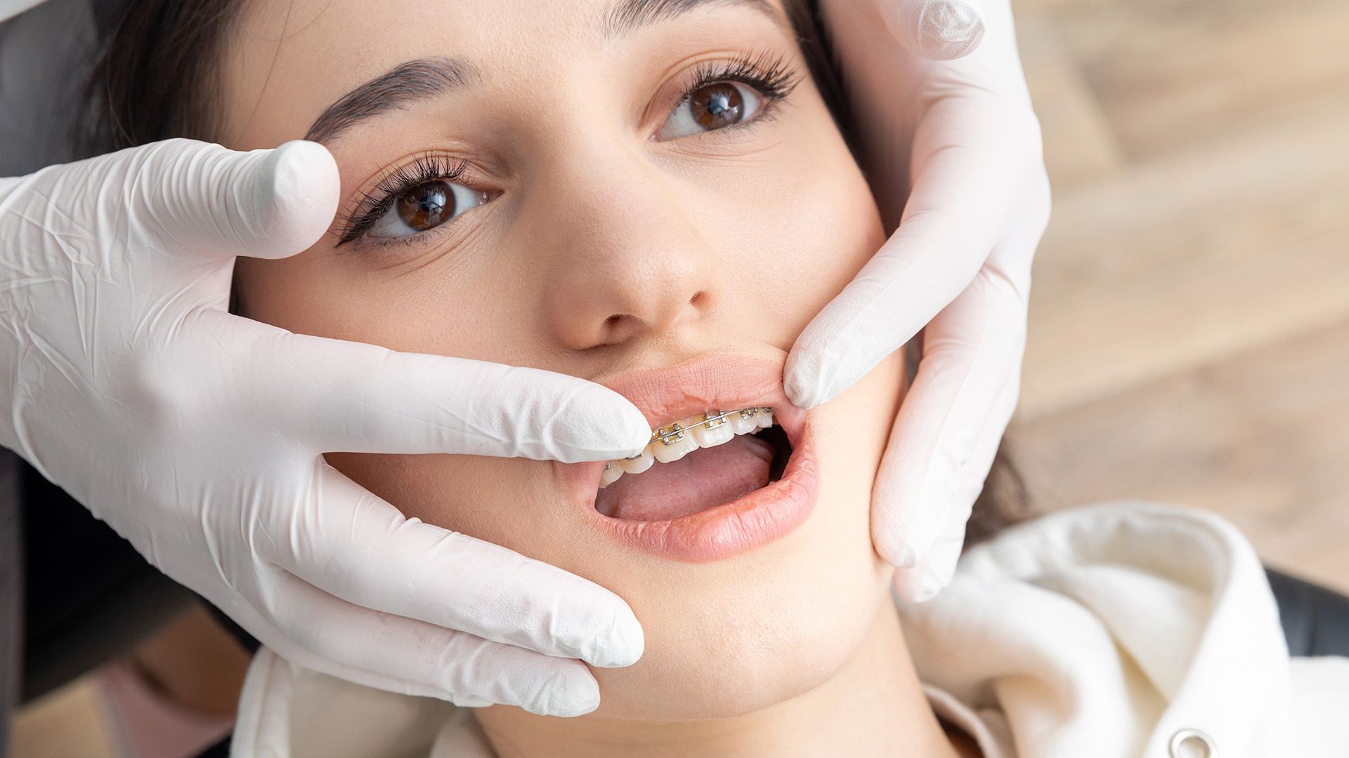 How to Stop an Orthodontic Wire from Poking Your Cheek