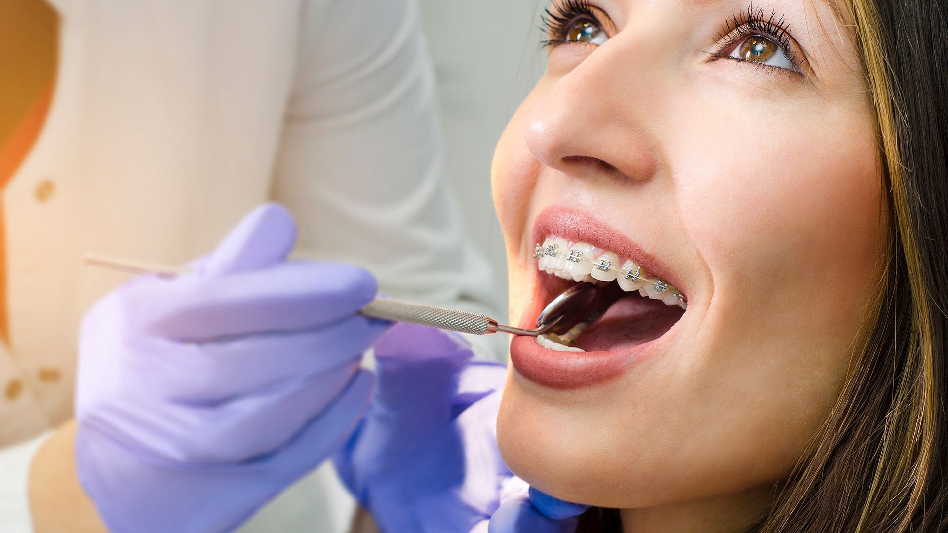 Broken Bracket? What To Do When You Have Broken Braces