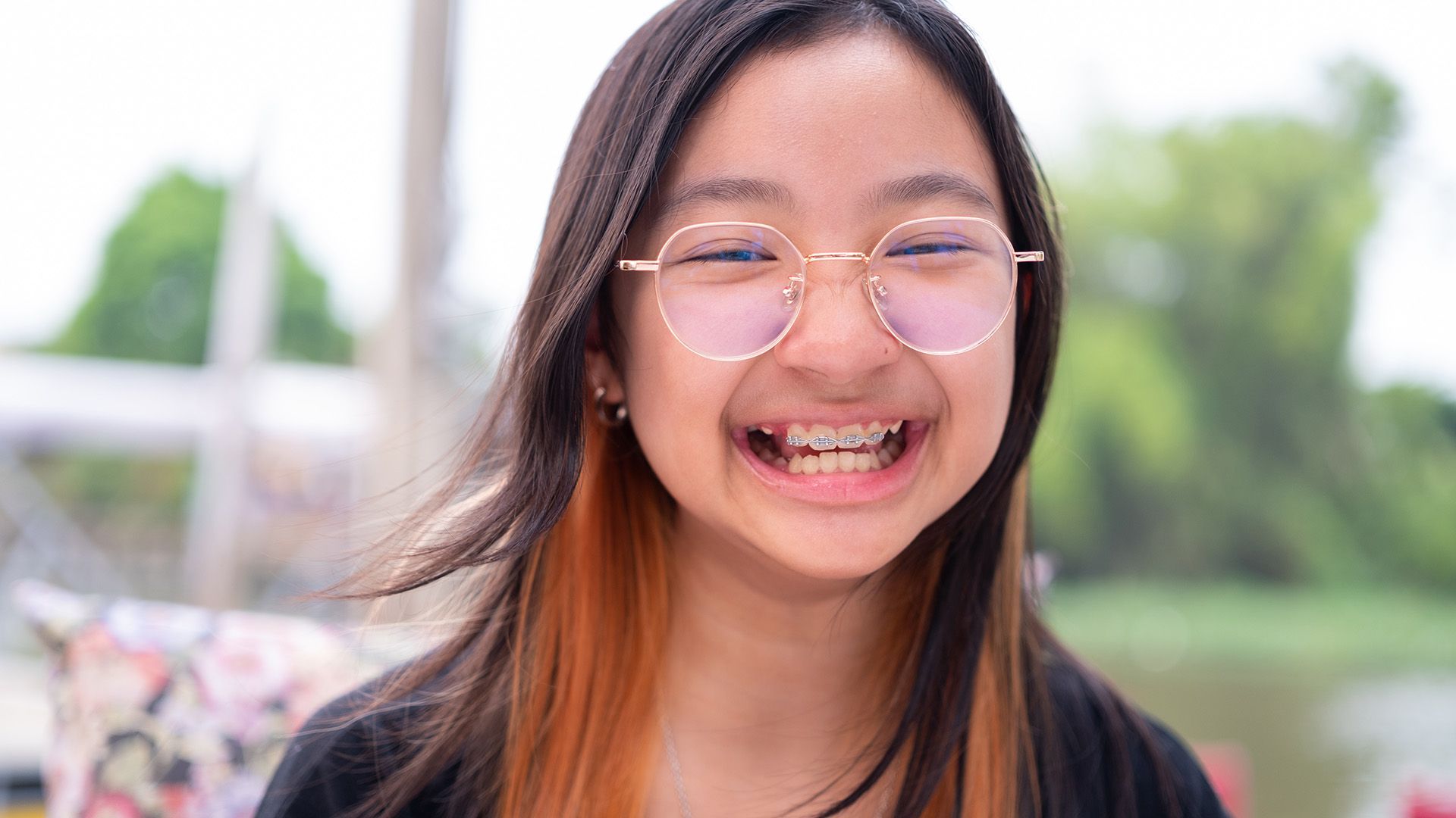 cost of braces for kids