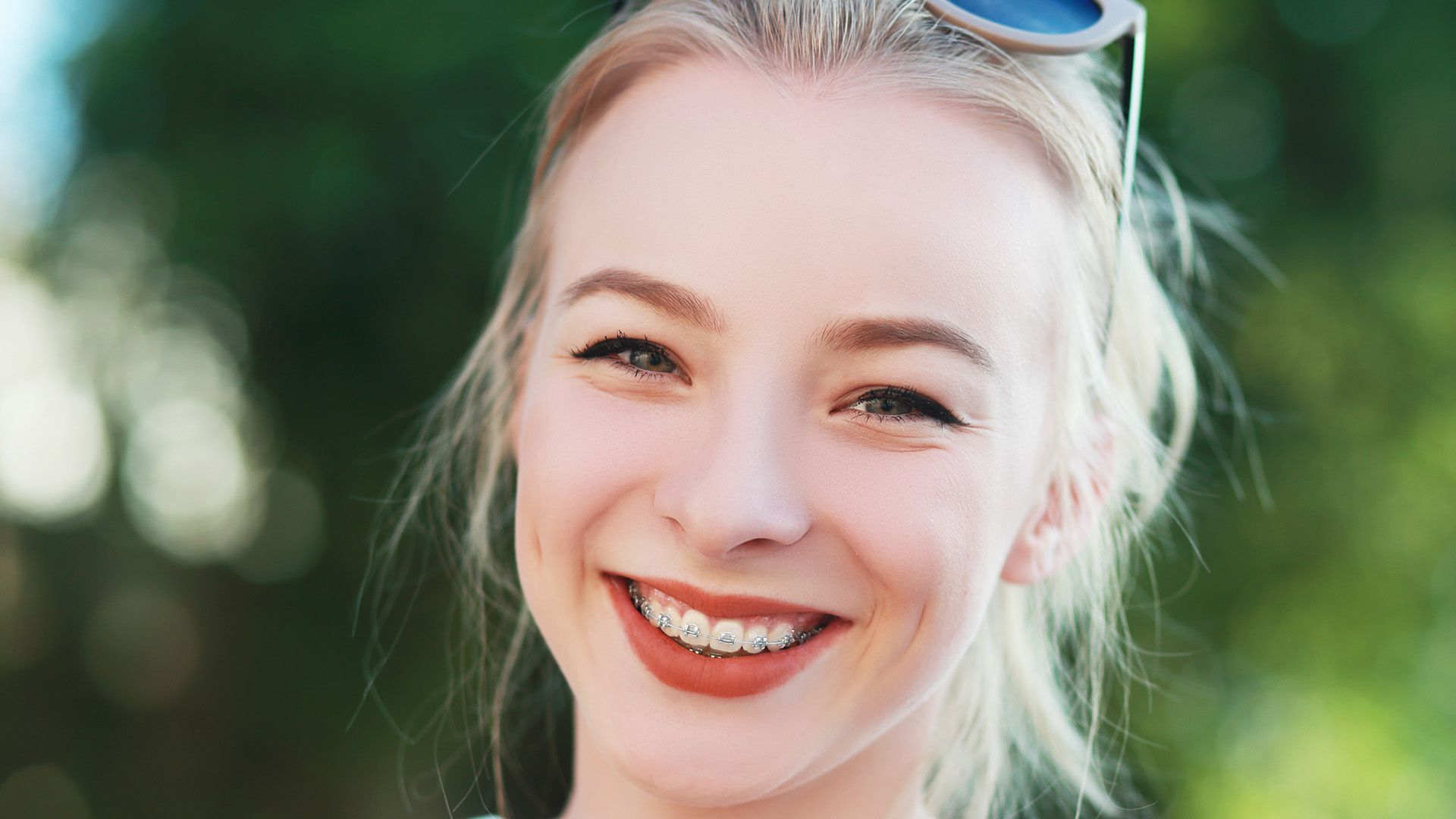 How Soon Can I Get Braces After Wisdom Teeth Removal