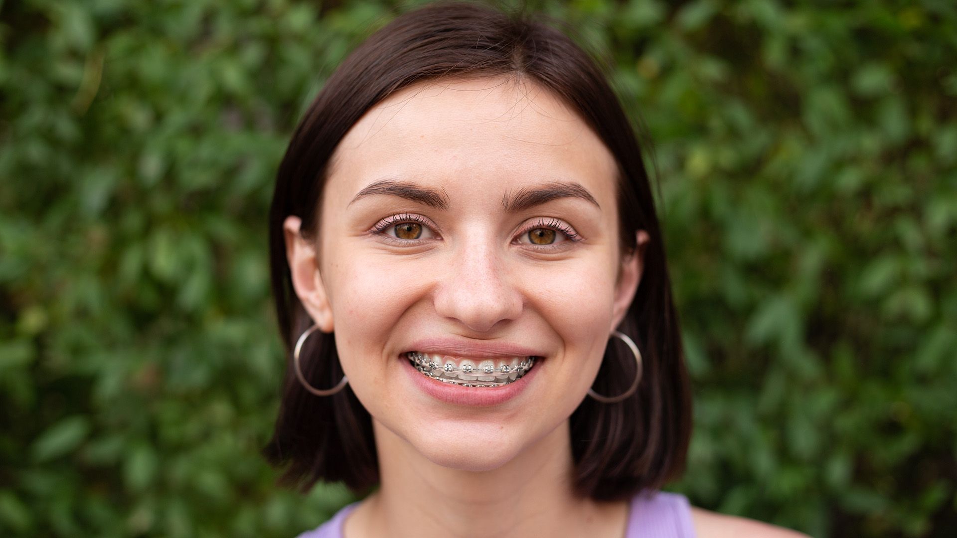metal braces for teeth