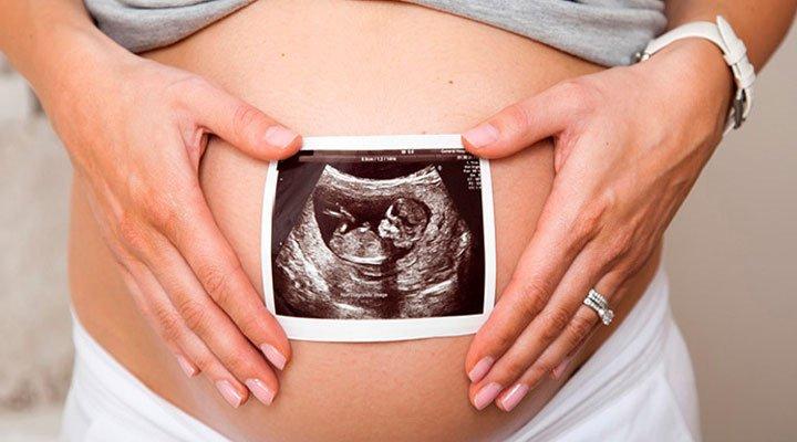 DRA. ALICIA PITALÚA ORDÓÑEZ - ginecología y obstetricia