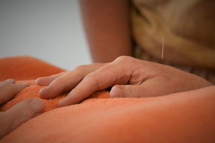 acupunctuur