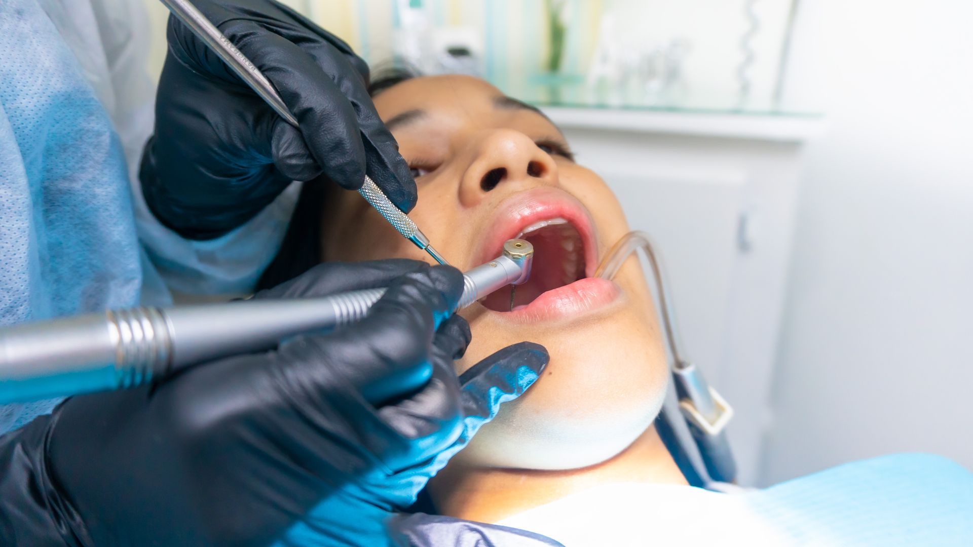 Cura dei denti Curare i denti, dentista vicino a me, salute della bocca, salute dentale, cura dei denti, dentista