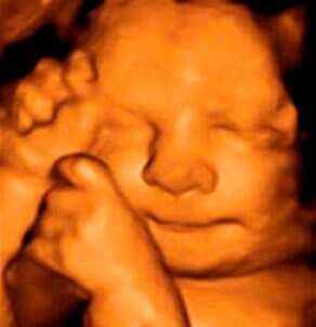 GINECOLOGOS CENTRO DE ESPECIALIDADES SANTA MARIA - ULTRASONIDO 3D